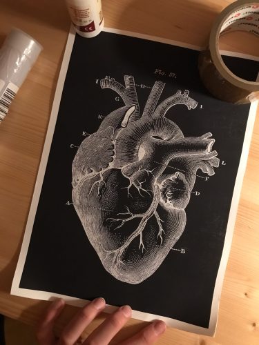 Human Anatomy Prints On Black Canvas photo review