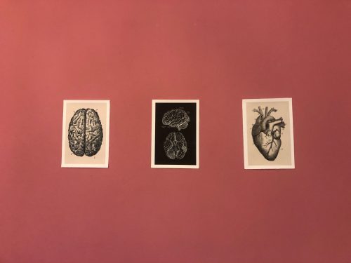 Human Anatomy Prints On Black Canvas photo review