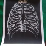 Human Anatomy Prints On Black Canvas photo review