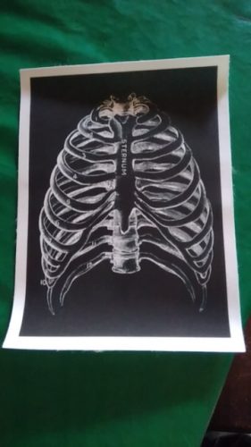Human Anatomy Prints On Black Canvas photo review