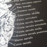 Human Anatomy Prints On Black Canvas photo review