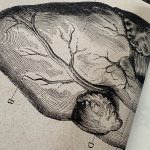 Human Anatomy Vintage Canvas Print photo review