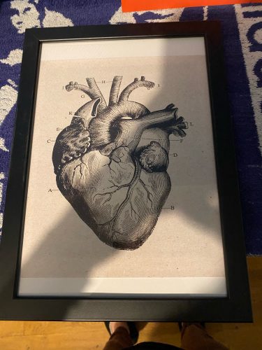 Human Anatomy Vintage Canvas Print photo review