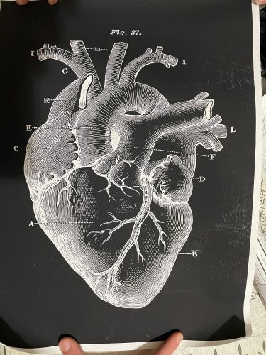Human Anatomy Prints On Black Canvas photo review