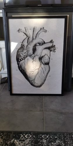 Human Anatomy Vintage Canvas Print photo review